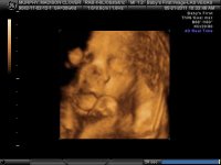 BABY MADISON CLOVER_31.jpg