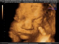 BABY MADISON CLOVER_60.jpg