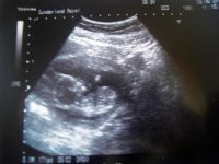 Pip1st p.jpg