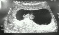 baby 1.jpg