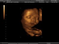 aubri ultrasound2.jpg