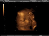 aubri ultrasound 4.jpg
