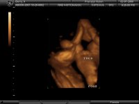 aubri ultrasound 5.jpg