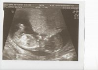12 week scan 001.jpg