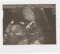 12 week scan 002.jpg