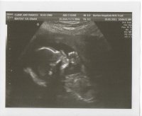 20 wk scan pics 001.jpg