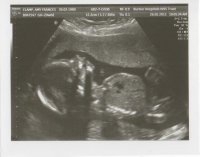 20 wk scan pics 002.jpg