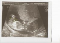 12 week scan 001.jpg