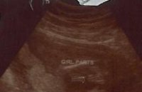 It's a girl!.JPG