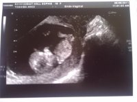 Aston or Lola-Mae 11w4d Scan.jpg