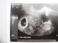 baby scan 005.jpg