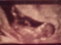 LEG & UMBILICAL CORD.jpg