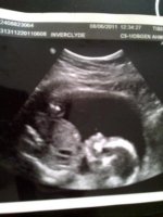 19wks.jpg