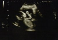 19weeks4days 2.jpg