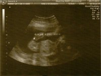 Ultrasound 15.4 (1).jpg