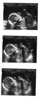 Josephine 20 week scan022.jpg