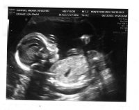 Josephine 20 week scan023.jpg