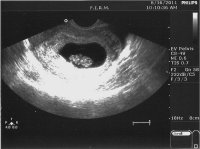 8wks.5days.6.16.11.jpg