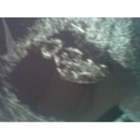 baby_8w2d.jpg