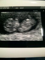 2nd pic of baby at 10+4.jpg