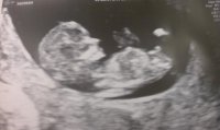 11week scan.jpg