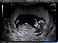 BABY_11.jpg