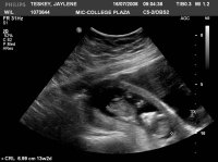 Baby.jpg