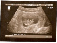 11week scan.jpg