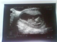 my baby 006.jpg