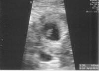 baby B smaller.jpg