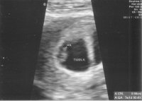 Baby A smaller.jpg