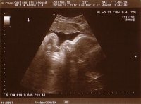 Dax 36 weeks.JPG