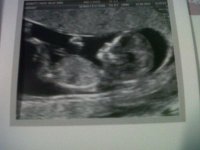 12 week scan.jpg