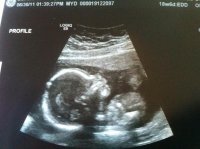 Baby 6-30-11.jpg