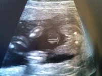gender 6-30-11.jpg