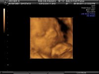 BABY_2_15.jpg