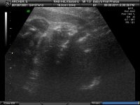 BABY_1_5.jpg