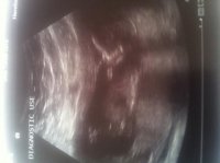 baby EDD 2012.jpg