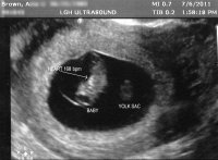 ultrasound_7w3db.jpg