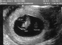ultrasound_7w3db.jpg