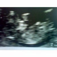 baby_12weeks.jpg
