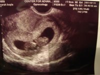 9+6 ultrasound (3).jpg