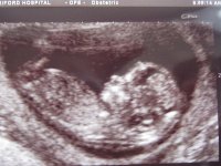 12 wks 13.7.11.jpg