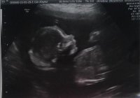 21 weeks - head&shoulders.jpg