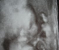 Brieanan Face 17 weeks.JPG