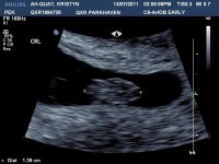 baby 8 weeks 2.jpg