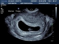 baby 8 weeks.jpg