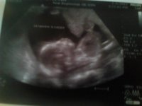 ultrasound 20e3ds.jpg