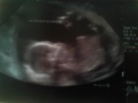 ultrasound 20w3d.jpg