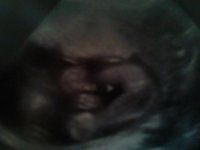 ultrasound girl 20w3d.jpg